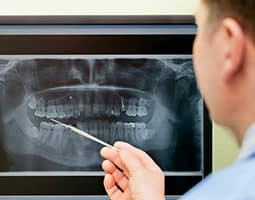 Dental X-rays in Naperville, Illinois