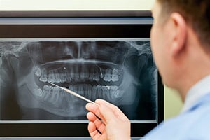 Dental X-rays in Naperville, Illinois