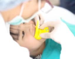 Fluoride Treatments in Naperville, Illinois