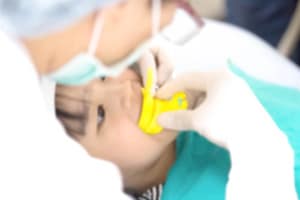 Fluoride Treatments in Naperville, Illinois