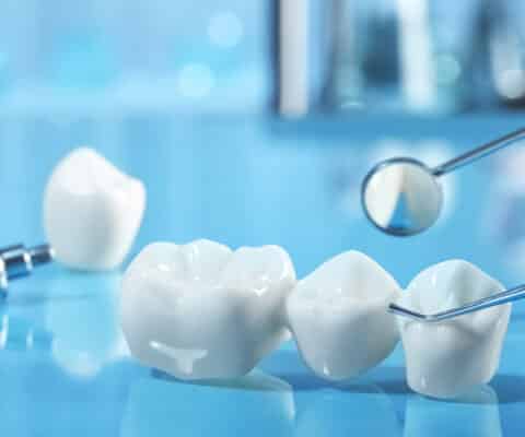 Dental Bridges in Naperville, Illinois