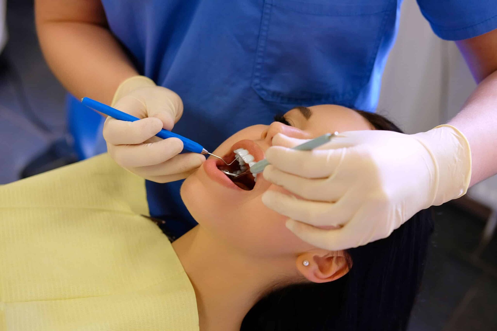 Gum Grafting in Naperville, Illinois